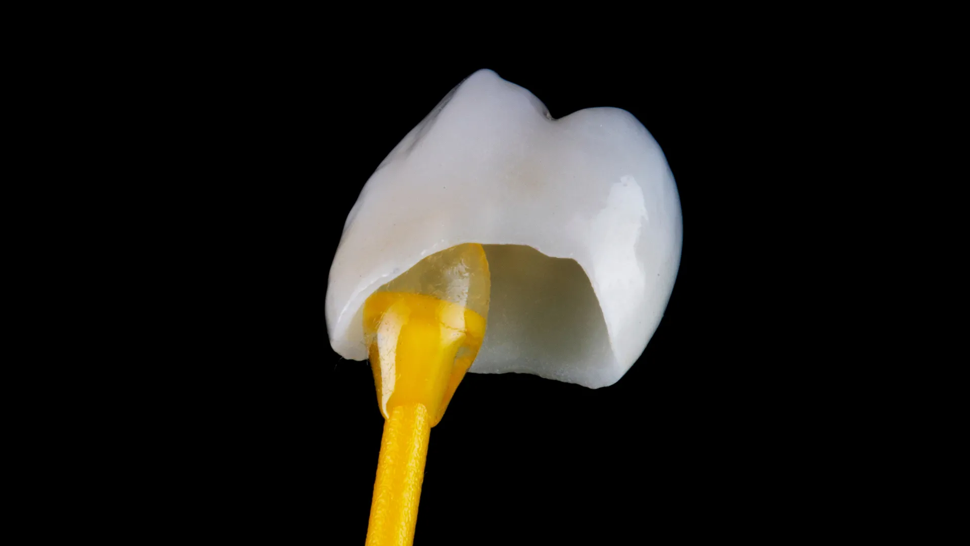 Zirkonyum Kaplama mı Porselen Kaplama mı? | Dent Otal Konya